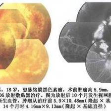 醫(yī)療利器 認(rèn)識與使用敷貼器